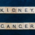 Prognosis Stage 4 Kidney Cancer