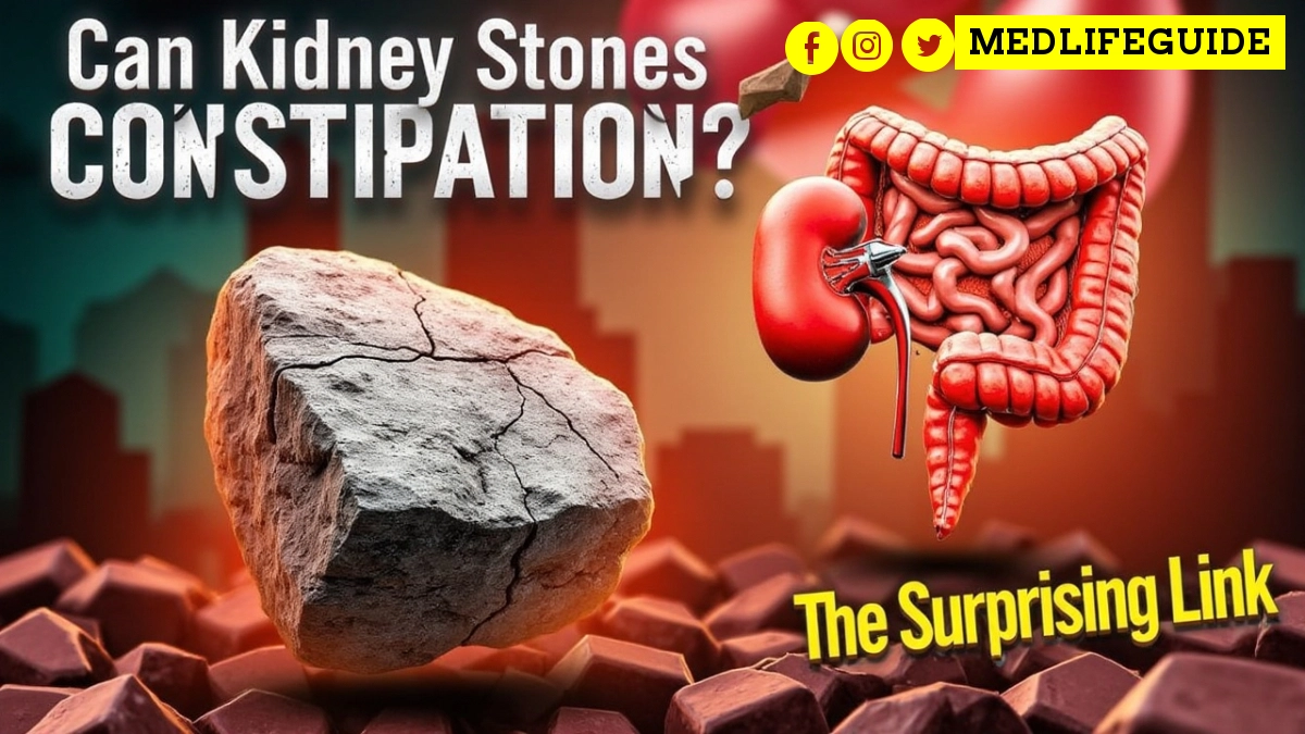 Can kidney stones cause constipation