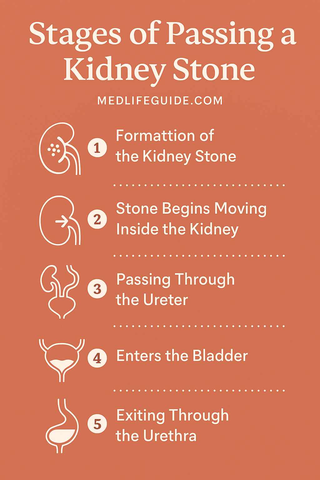 Stages of Passing a Kidney Stone