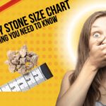 8mm Kidney Stone Size Chart