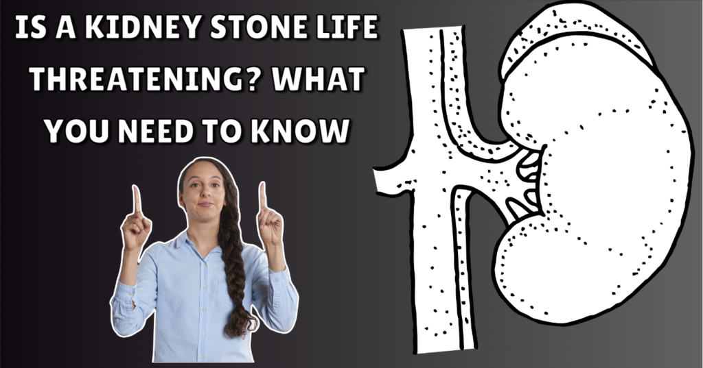 Kidney Stone Life Threatening