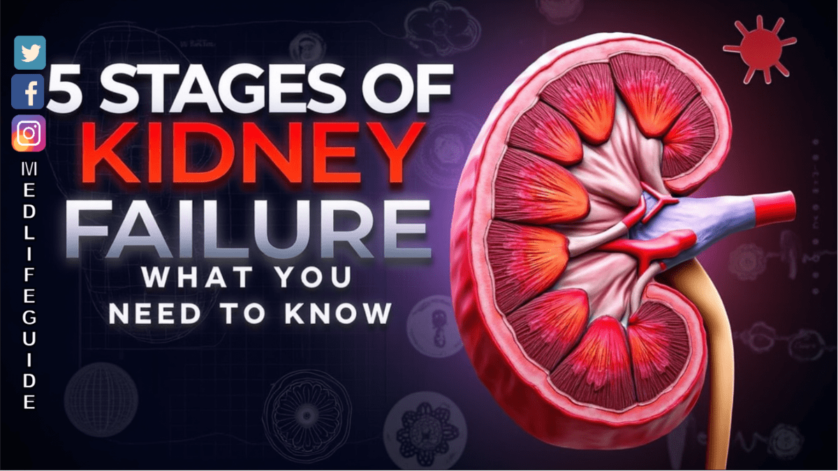 What Are the 5 Stages of Acute Kidney Failure