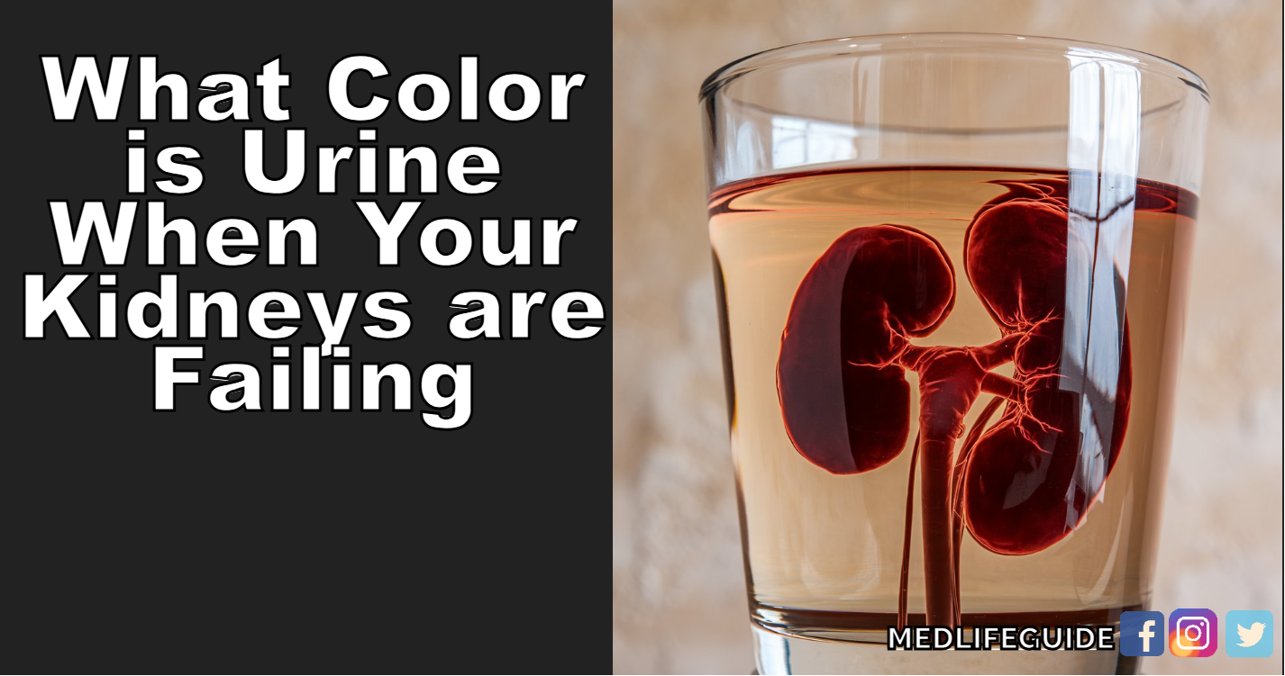 What Color is Urine When Your Kidneys are Failing