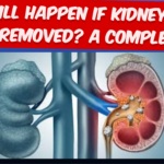 What Will Happen If Kidney Stones Are Not Removed A Complete Guide