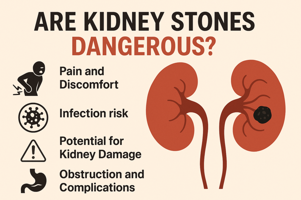 Are Kidney Stones Dangerous