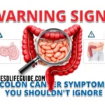 colon cancer symptoms