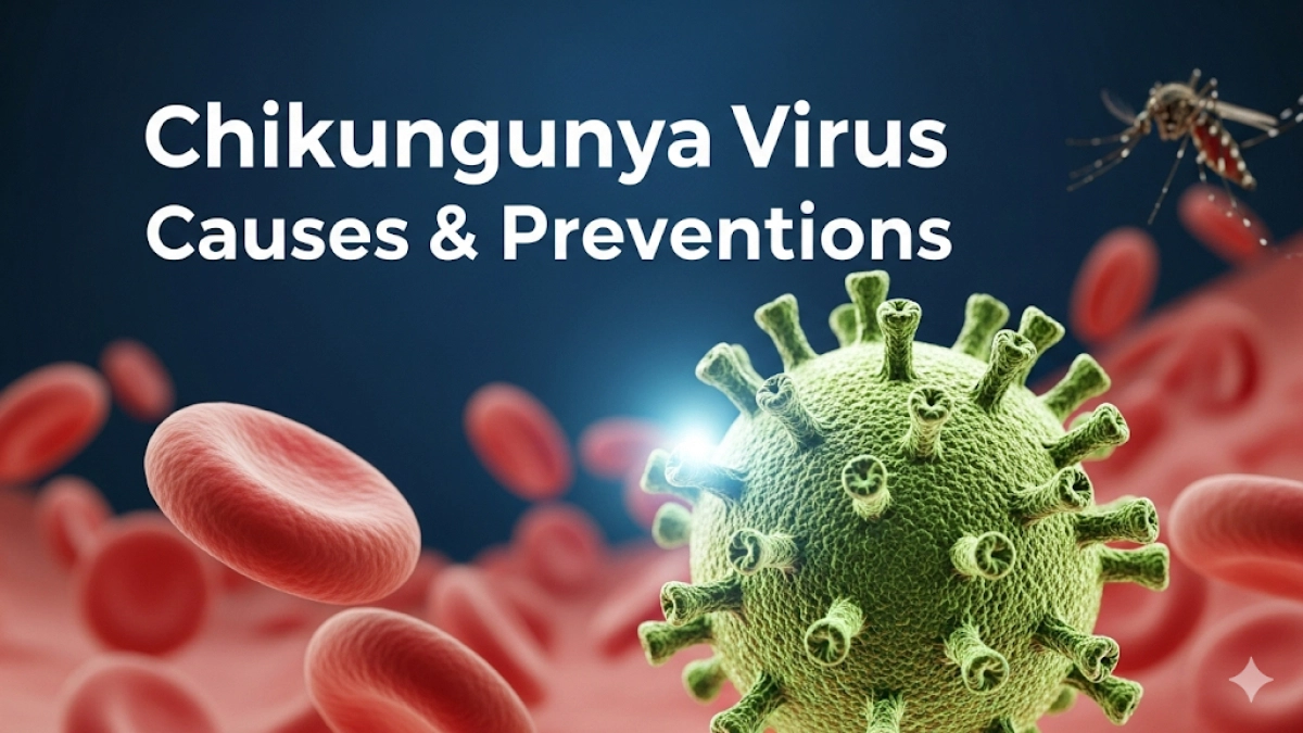 Chikungunya Virus Causes and Preventions