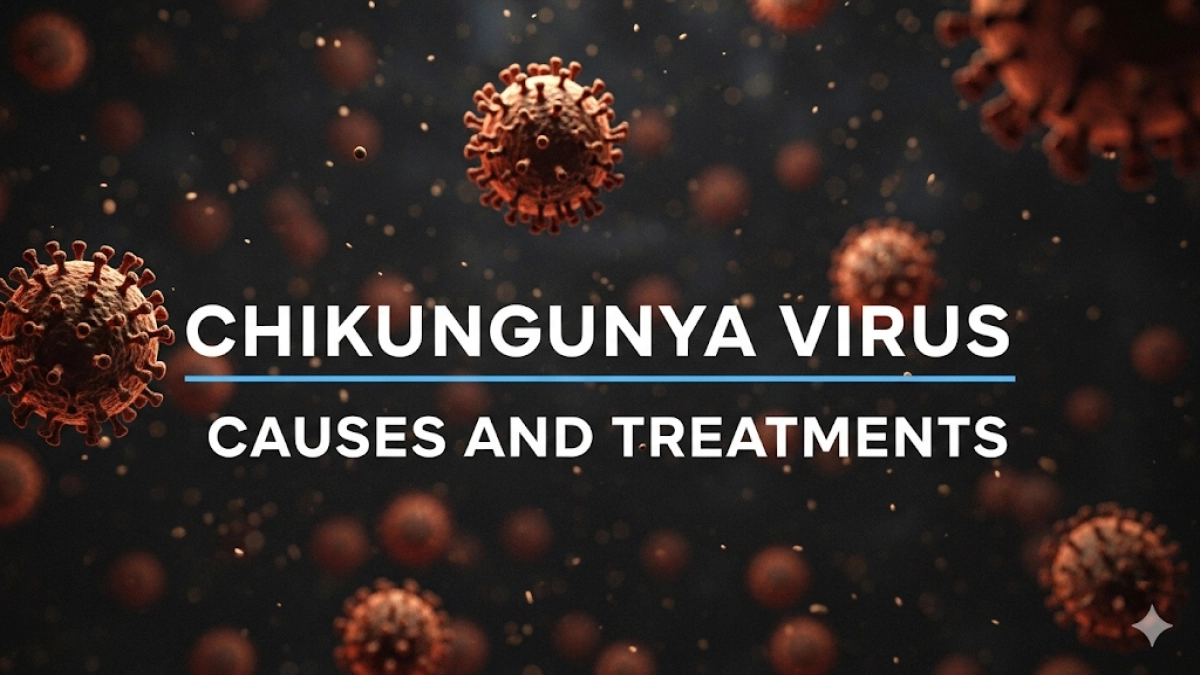 Chikungunya Virus Causes and Treatments