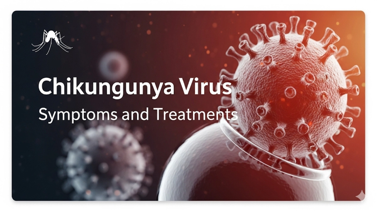 Chikungunya Virus Symptoms and Treatments