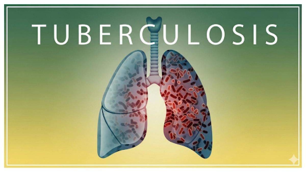 tuberculosis