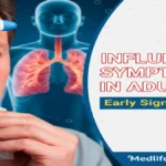 Influenza Symptoms in Adults by medlifeguide