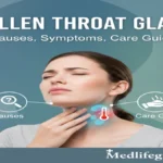 Visual guide to swollen throat glands, detailing causes, symptoms, and treatments by Medlifeeguide.