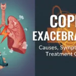 COPD Exacerbation explained by medlifeguide