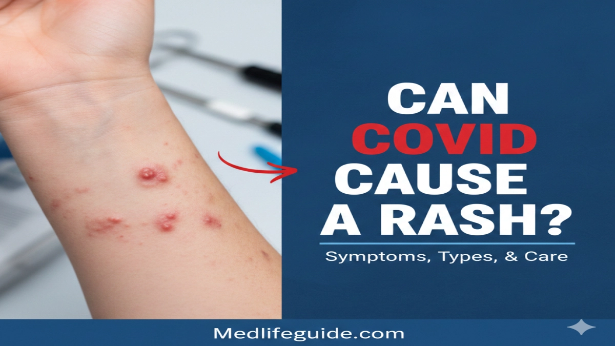 Can COVID Cause a Rash