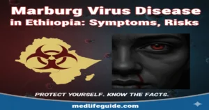 Marburg Virus Disease in Ethiopia