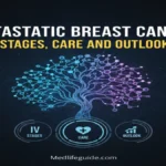 Metastatic Breast Cancer by medlifeguide