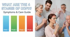 What are the 4 Stages of COPD