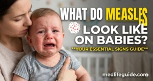 What Do Measles Look Like on Babies Signs Guide