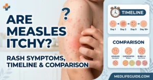 Are Measles Itchy